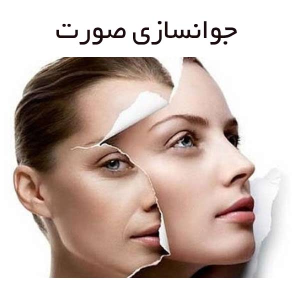 خرید مزوژل سونه‌ کاس